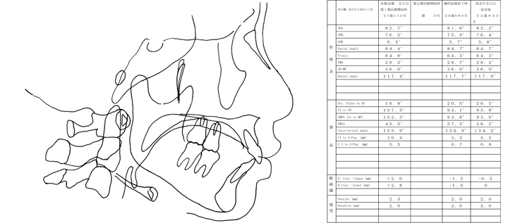 側貌頭部X線規格写真透写図分析の一例